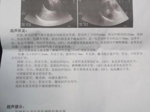 办公室强肝是好事还是恶性、办公室强肝：是好事还是恶性？