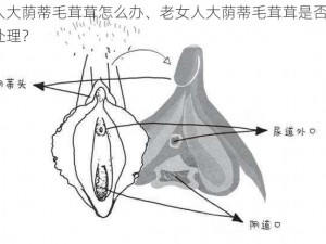 老女人大荫蒂毛茸茸怎么办、老女人大荫蒂毛茸茸是否正常？如何处理？