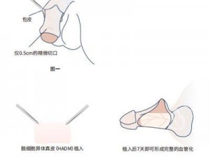 变粗变大的训练方法图片【如何通过训练让某个部位变粗变大？这里有方法图片】