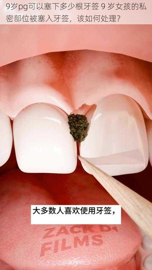 9岁pg可以塞下多少根牙签 9 岁女孩的私密部位被塞入牙签，该如何处理？