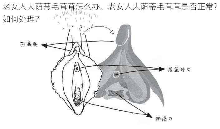 老女人大荫蒂毛茸茸怎么办、老女人大荫蒂毛茸茸是否正常？如何处理？