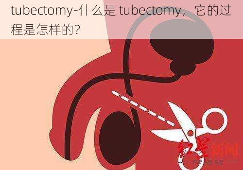 tubectomy-什么是 tubectomy，它的过程是怎样的？